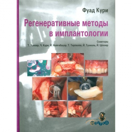 Стоматология, книга Регенеративные методы в имплантологии заказать