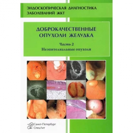 Онкология, книга Доброкачественные опухоли желудка. Неэпителиальные  опухоли. Часть 2 заказать