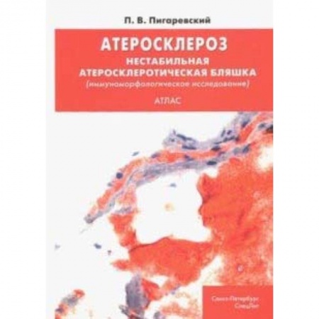 Кардиология, книга Атеросклероз. Нестабильная атеросклеротическая бляшка (иммуноморфологическое исследование). Атлас заказать