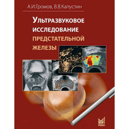 УЗИ. ЭКГ. Томография. Рентген, книга Ультразвуковое исследование предстательной железы заказать