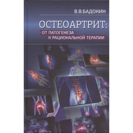 Внутренние болезни. Диагностика, книга Остеоартрит: от патогенеза к рациональной терапии заказать