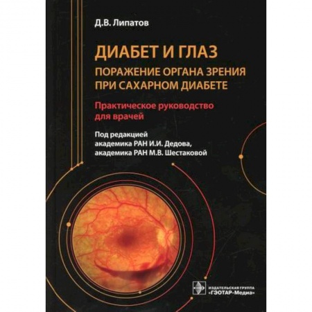 Офтальмология, книга Диабет и глаз. Поражение органа зрения при сахарном диабете заказать