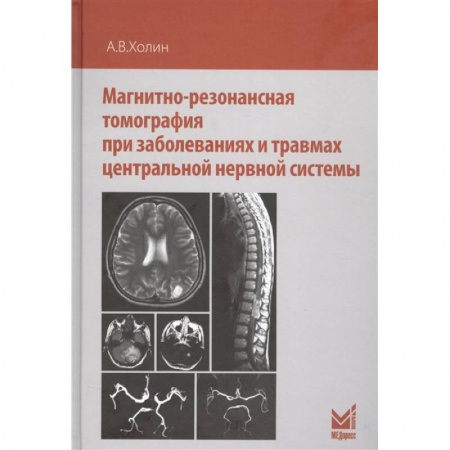 УЗИ. ЭКГ. Томография. Рентген, книга Магнитно-резонансная томография при заболеваниях и травмах центральной нервной системы заказать