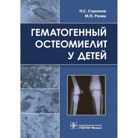 Медицина. Фармакология, книга Гематогенный остеомиелит у детей заказать
