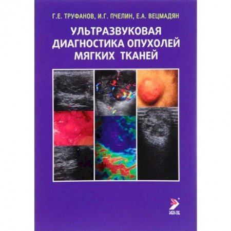 УЗИ. ЭКГ. Томография. Рентген, книга Ультразвуковая диагностика опухолей мягких тканей заказать