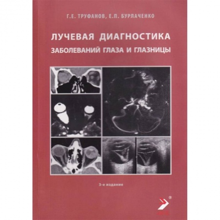 Специальная медицина, книга Лучевая диагностика заболеваний глаза и глазницы заказать