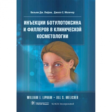 Кожные и венерические болезни, книга Инъекции ботулотоксина и филлеров в клинической косметологии заказать