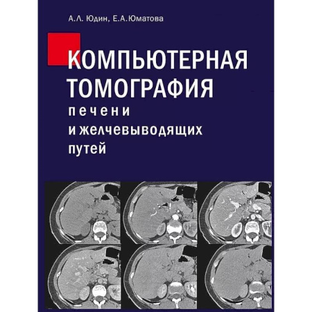УЗИ. ЭКГ. Томография. Рентген, книга Компьютерная томография печени и желчевыводящих путей: практическое руководство заказать