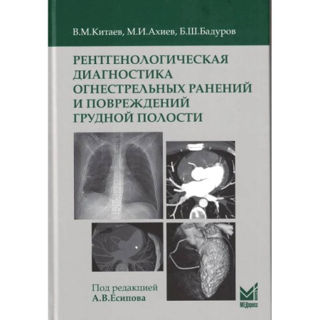 УЗИ. ЭКГ. Томография. Рентген, книга Рентгенологическая диагностика огнестрельных ранений и повреждений грудной полости заказать
