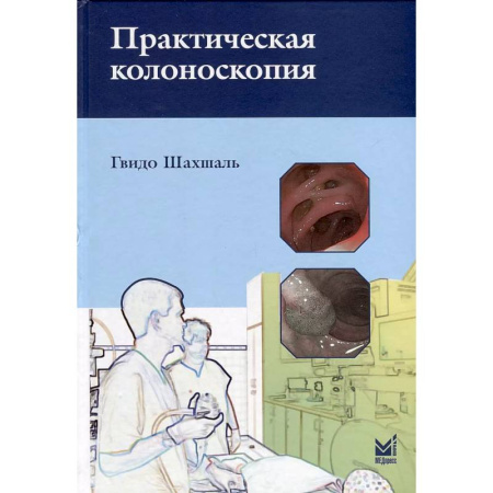 Медицинские энциклопедии и справочники, книга Практическая колоноскопия. Методика, рекомендации, советы и приемы заказать