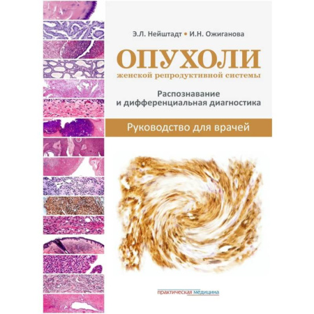 Здоровье, медицинская литература, книга Опухоли женской репродуктивной системы. Распознавание и дифференциальная диагностика. Руководство для врачей заказать