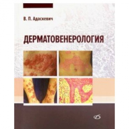 Кожные и венерические болезни, книга Дерматовенерология заказать