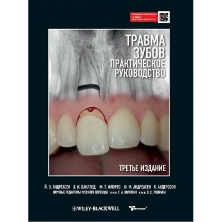 Стоматология, книга Травма зубов. Практическое руководство заказать