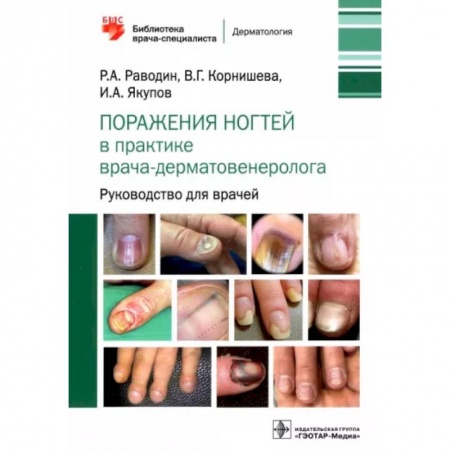 Кожные и венерические болезни, книга Поражения ногтей в практике врача-дерматовенеролога. Руководство для врачей заказать
