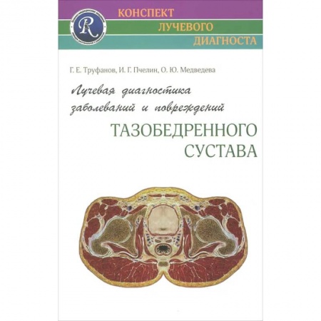 Онкология, книга Лучевая диагностика заболеваний и повреждений тазобедренного сустава заказать