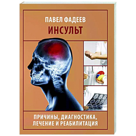 Кардиология, книга Инсульт. Причины, диагностика, лечение и реабилитация заказать