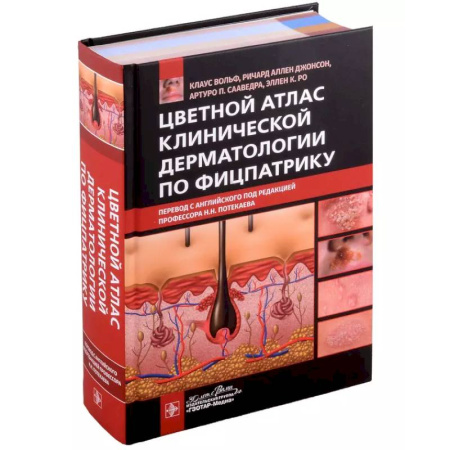 Кожные и венерические болезни, книга Цветной атлас клинической дерматологии по Фицпатрику заказать