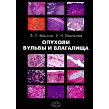 Акушерство и гинекология, книга Опухоли вульвы и влагалища заказать