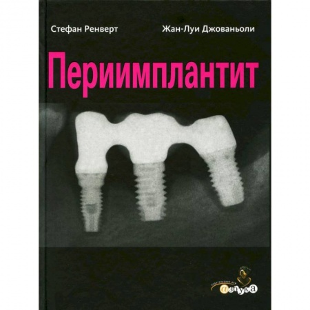 Стоматология, книга Периимплантит заказать