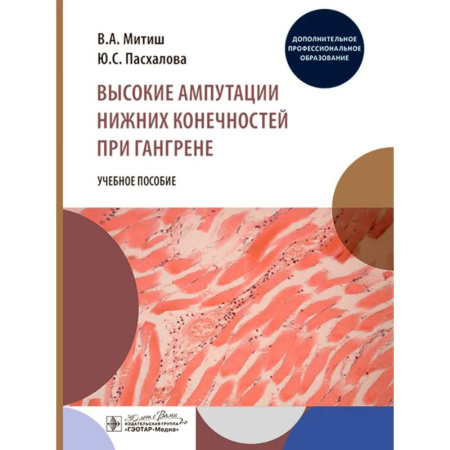 Медицинские энциклопедии и справочники, книга Высокие ампутации нижних конечностей при гангрене заказать