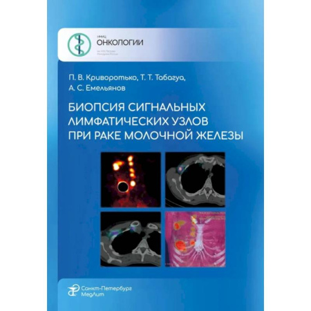 Онкология, книга Биопсия сигнальных лимфатических узлов при раке молочной железы заказать