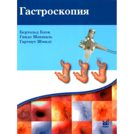 Гастроэнтерология, книга Гастроскопия заказать