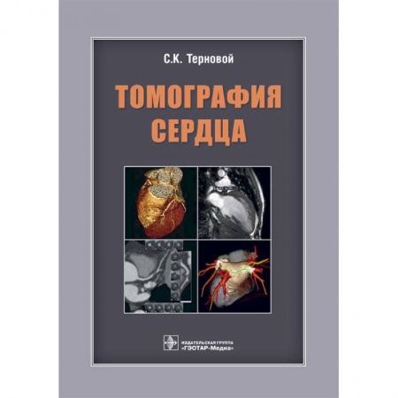 Кардиология, книга Томография сердца. Руководство для врачей заказать