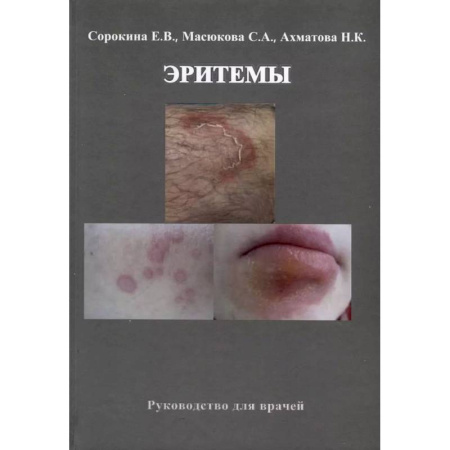 Кожные и венерические болезни, книга Эритемы. Руководство для врачей заказать