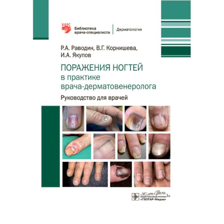 Медицинские энциклопедии и справочники, книга Поражения ногтей в практике врача-дерматовенеролога: руководство для врачей заказать