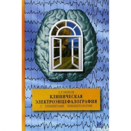 УЗИ. ЭКГ. Томография. Рентген, книга Клиническая электроэнцефалография (с элементами эпилептологии) заказать