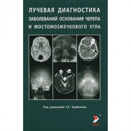 Неврология, книга Лучевая диагностика заболеваний оснований черепа и мостмозжечкового угла заказать