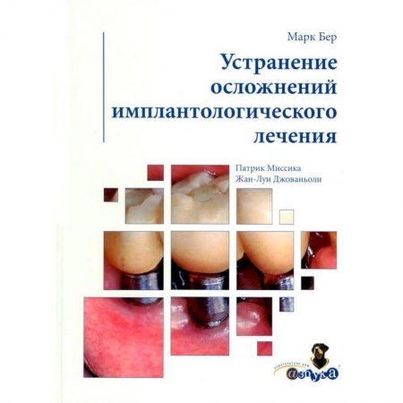 Стоматология, книга Устранение осложнений имплантологического лечения заказать