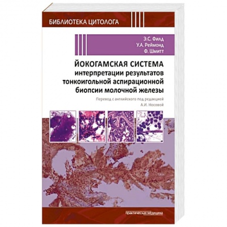 Медицинские энциклопедии и справочники, книга Йокогамская система интерпретации результатов тонкоигольной аспирационной биопсии молочной железы заказать