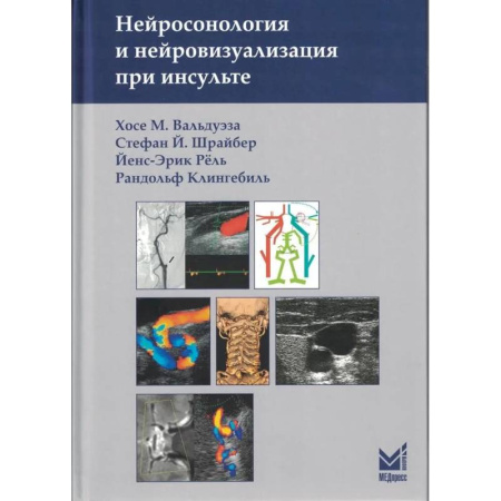 Кардиология, книга Нейросонология и нейровизуализация при инсульте заказать