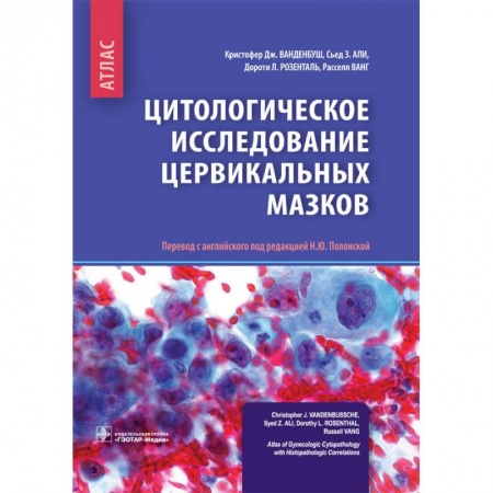 Прививки. Вакцины, книга Цитологическое исследование цервикальных мазков. Атлас заказать