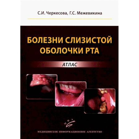 Другие виды специальной медицины, книга Болезни слизистой оболочки рта: атлас заказать