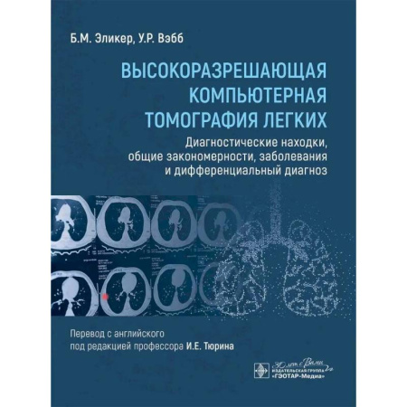 Медицинские энциклопедии и справочники, книга Высокоразрешающая компьютерная томография легких. Диагностические находки, общие закономерности, заболевания и дифференциальный диагноз заказать