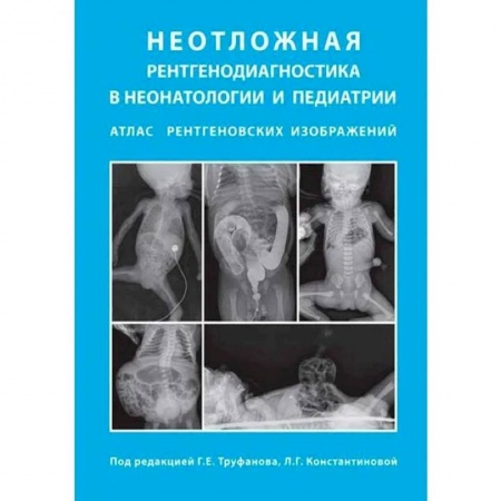 Педиатрия, книга Неотложная рентгенодиагностика в неонатологии и педиатрии заказать