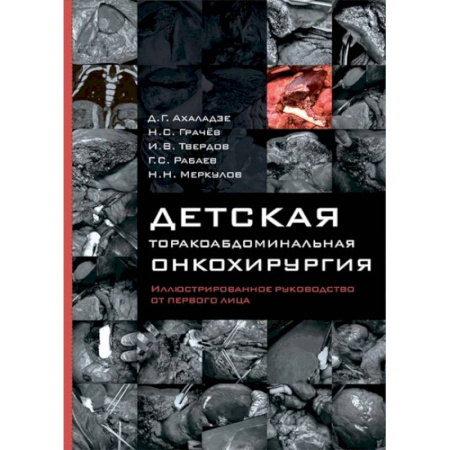 Онкология, книга Детская торакоабдоминальная онкохирургия. Иллюстрированное руководство от первого лица заказать
