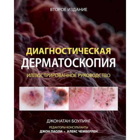 Кожные и венерические болезни, книга Диагностическая дерматоскопия: иллюстрированное руководство заказать