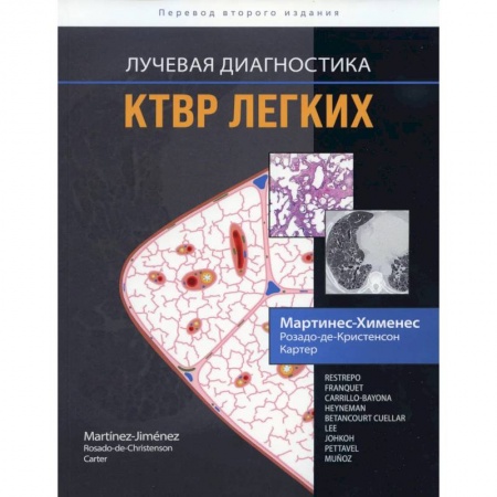 Книги, книга Лучевая диагностика. КТВР легких заказать
