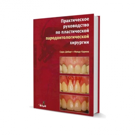 Стоматология, книга Практическое руководство по пластической парадонтологической хирургии заказать