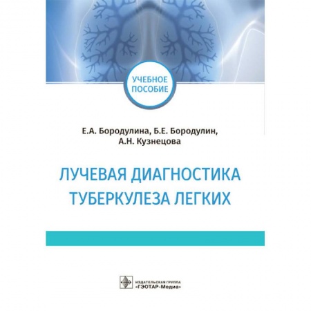 Терапия. Пульмонология, книга Лучевая диагностика туберкулеза легких заказать