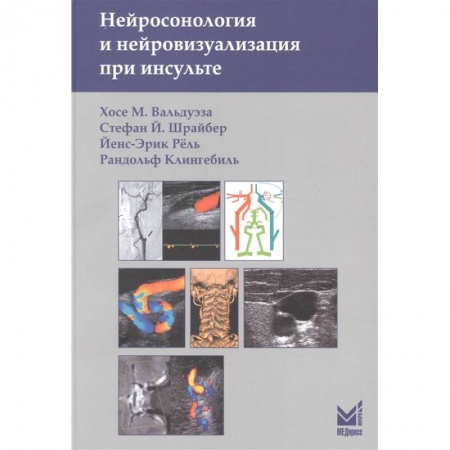 Специальная медицина, книга Нейросонология и нейровизуализация при инсульте заказать