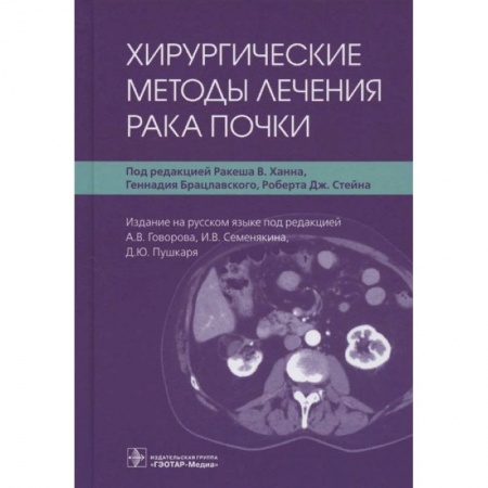 Урология, книга Хирургические методы лечения рака почки заказать