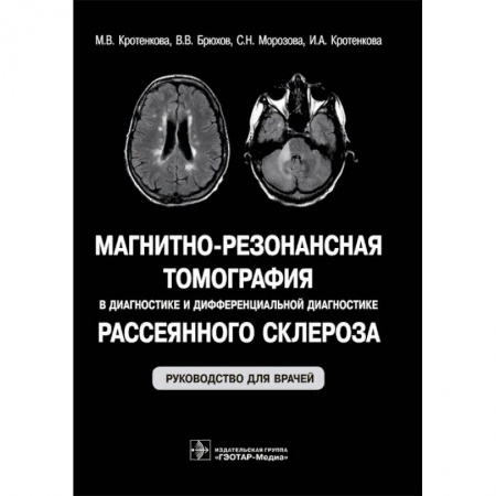 УЗИ. ЭКГ. Томография. Рентген, книга Магнитно-резонансная томография в диагностике и дифференциальной диагностике рассеянного склероза заказать