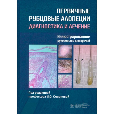 Кожные и венерические болезни, книга Первичные рубцовые алопеции. Диагностика и лечение. Иллюстрированное руководство для врачей заказать
