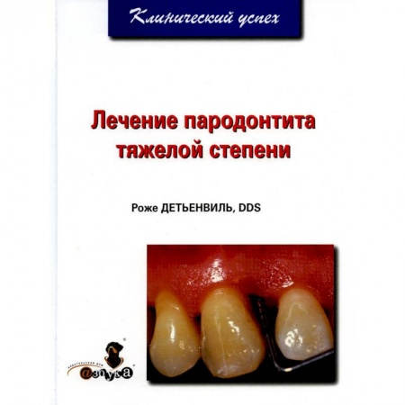 Стоматология, книга Лечение пародонтита тяжелой степени заказать