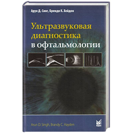 УЗИ. ЭКГ. Томография. Рентген, книга Ультразвуковая диагностика в офтальмологии заказать