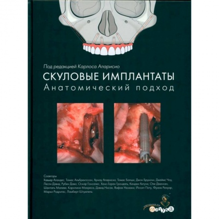 Стоматология, книга Скуловые имплантаты. Анатомический подход заказать